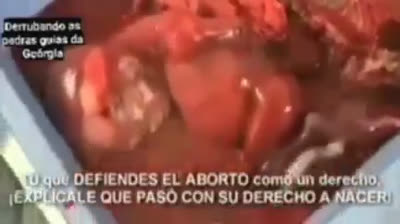 ¿Ustedes saben de qué hacen las cremas para la cara... ¡Aca esta la respuesta! (IMAGENES MUY FUERTES, POR FAVOR, COMPARTIR)