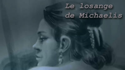 Le losange de Michaelis.