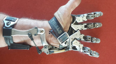 An engineer creates his own mechanical prosthesis